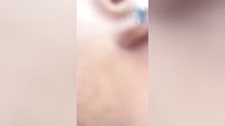Man Attacked With Machete In Dominican Republic