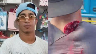 Man Attacked With Machete In Dominican Republic