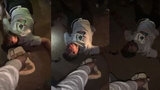 Man Suffers Seizure After Falling Head First Off His Motobike