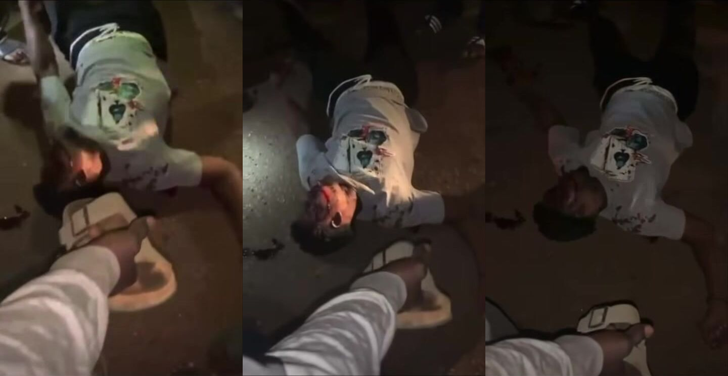 Man Suffers Seizure After Falling Head First Off His Motobike