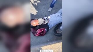 Biker's Leg Destroyed In Accident
