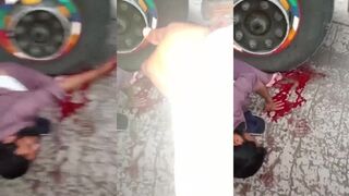 Legs crushed by truck