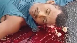 Skull Cracked And Bones Exposed - Aftermath Of Deadly Motorcycle Accident