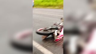 Skull Cracked And Bones Exposed - Aftermath Of Deadly Motorcycle Accident