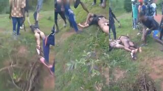 Removal of penis from body