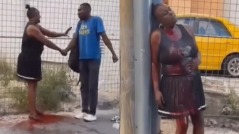 Man Runs Away After Stabbing GF, Leaves Her Bleeding