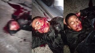 Thief Shot During Robbery In Pavuna/RJ Regrets It All