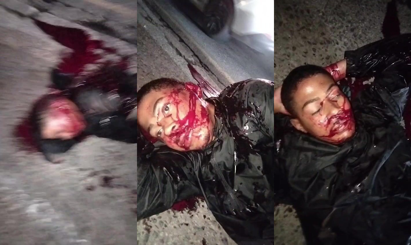 Thief Shot During Robbery In Pavuna/RJ Regrets It All