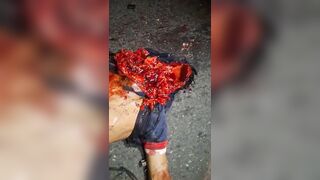 Gruesome Aftermath Of Traffic Accident In Ecuador