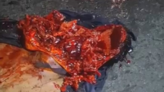 Gruesome Aftermath Of Traffic Accident In Ecuador