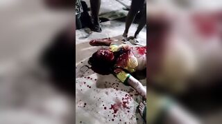 Woman Shot Twice Dies In Terrible Agony