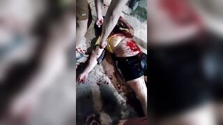 Woman Shot Twice Dies In Terrible Agony