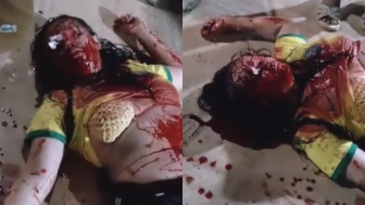 Woman Shot Twice Dies In Terrible Agony
