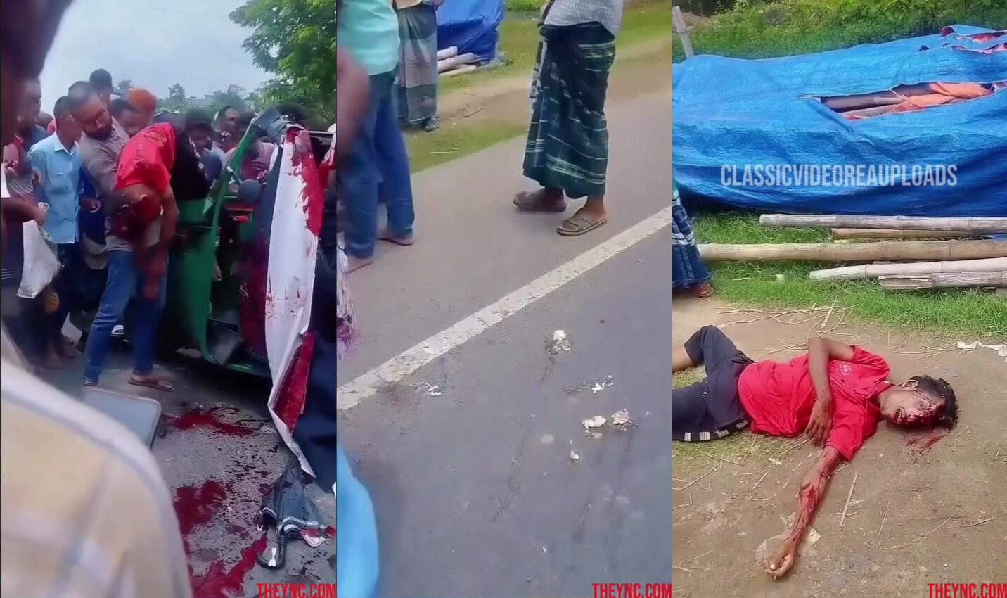 Classic: Guy with his head partially obliterated