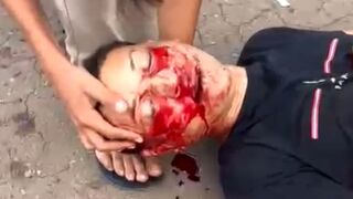 The Disturbing Sound Of Agony