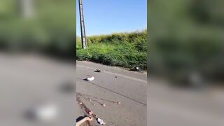 Skull Cracked Following Traffic Accident
