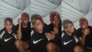 Disgusting: Two Bleeding Thieves Forced To Kiss Each Other After Being Caught Red Handed In São João de Meriti