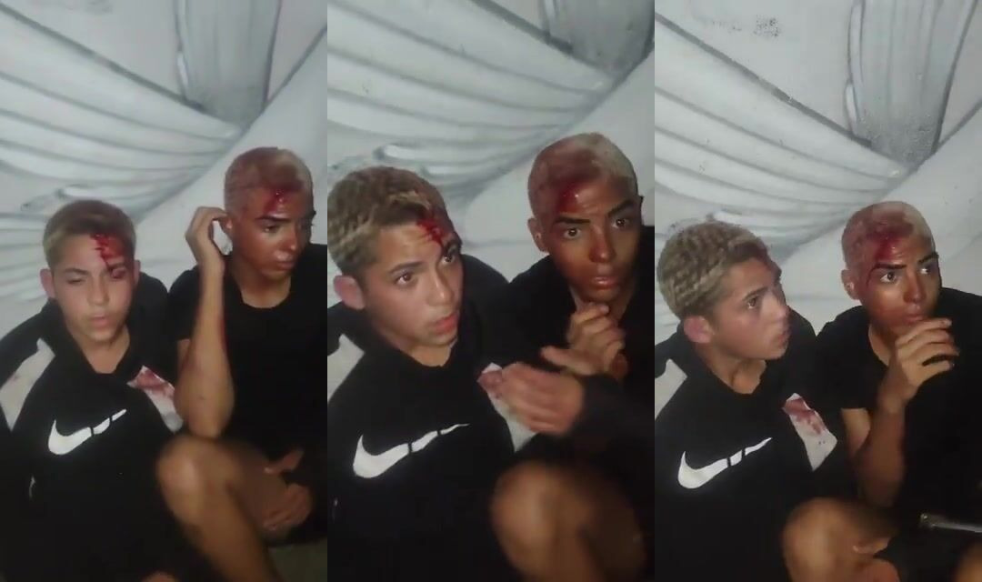 Disgusting: Two Bleeding Thieves Forced To Kiss Each Other After Being Caught Red Handed In São João de Meriti
