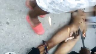 Compilation of penis removal