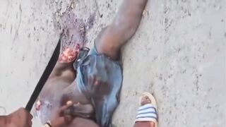 Compilation of penis removal