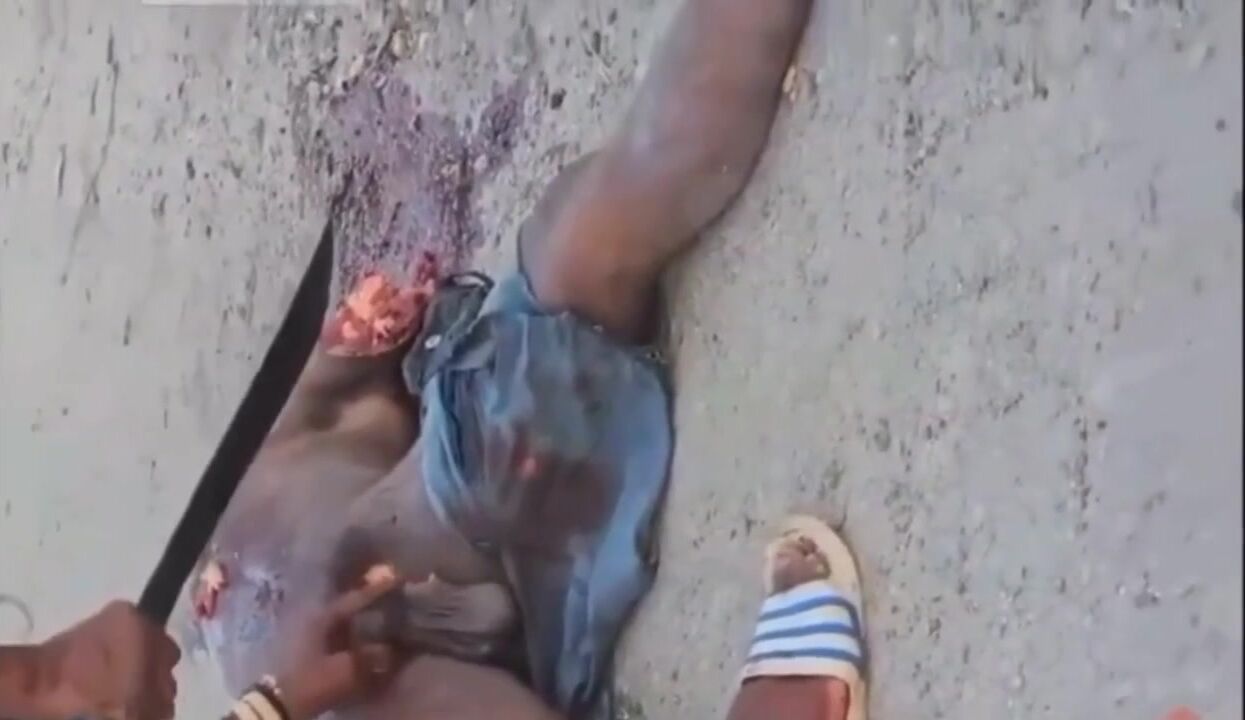 Compilation of penis removal