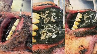 the corpse's mouth is full of larvae