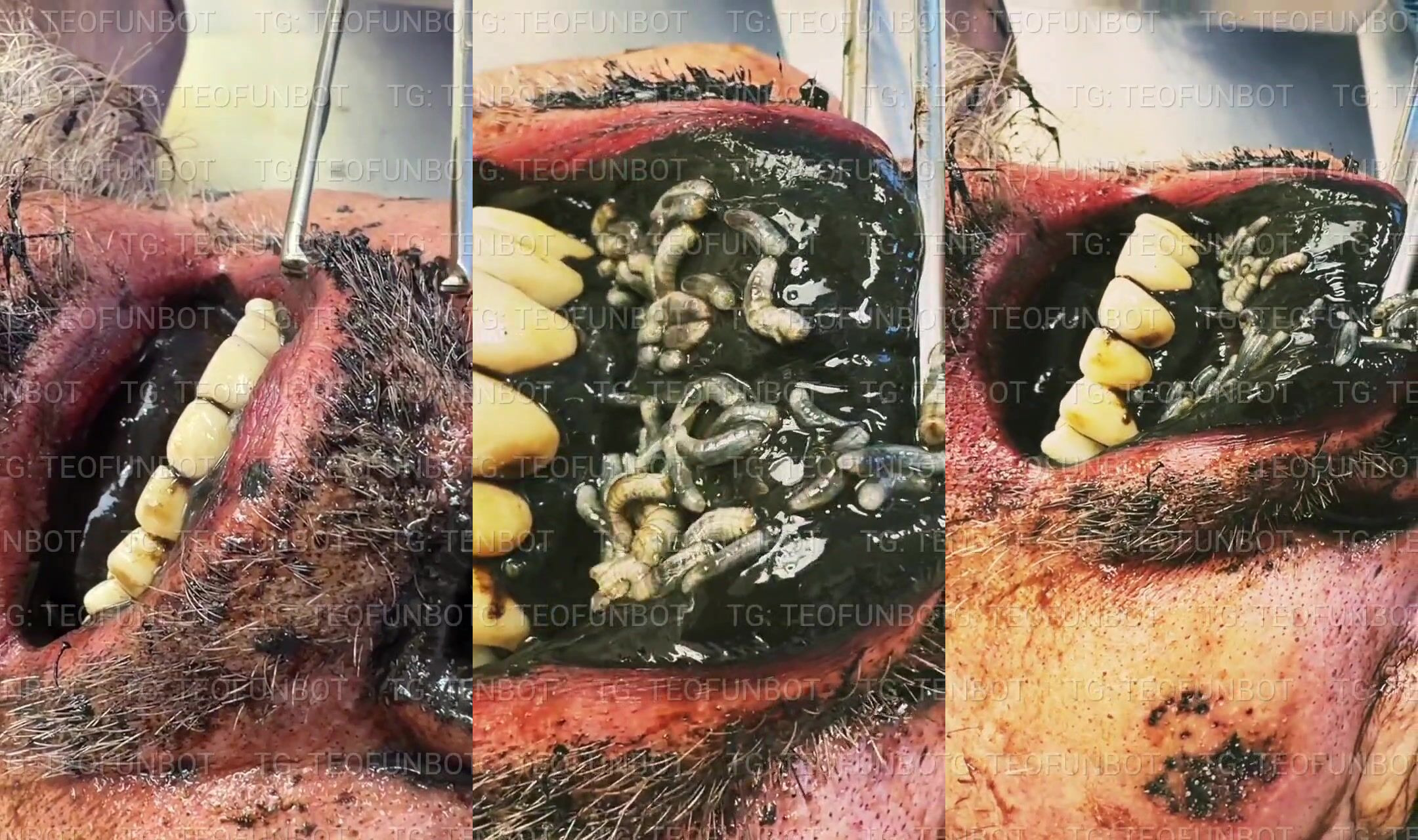 the corpse's mouth is full of larvae