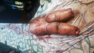 Compilation of dismembered women