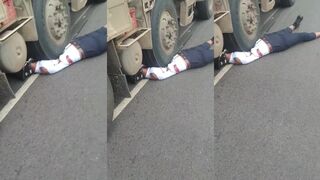 Stepped on by truck