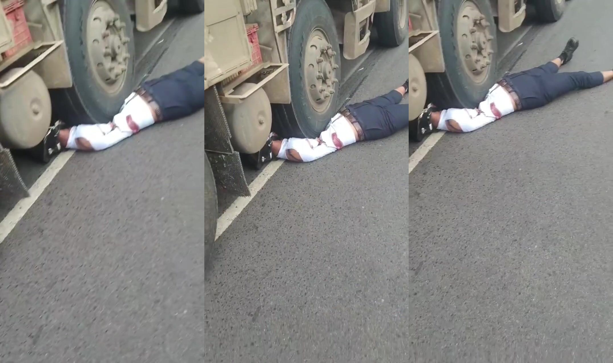 Stepped on by truck