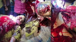 Throat sliced by local thugs