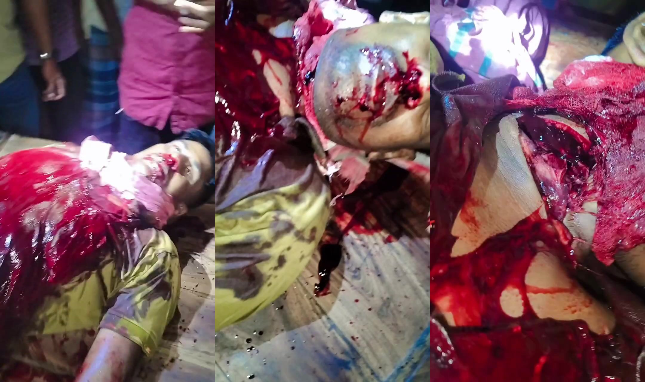 Throat sliced by local thugs