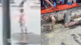 Mentally Ill Man Self Immolates In Turkey