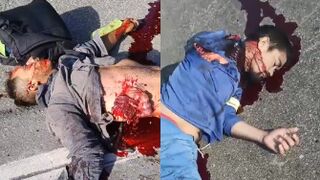 Motorcyclist Suffers Gruesome Injuries Lying Next to His Lifeless Friend