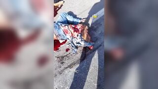 Motorcyclist Suffers Gruesome Injuries Lying Next to His Lifeless Friend