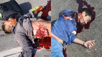 Motorcyclist Suffers Gruesome Injuries Lying Next to His Lifeless Friend