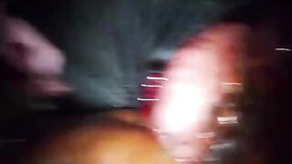 Accident with intestines