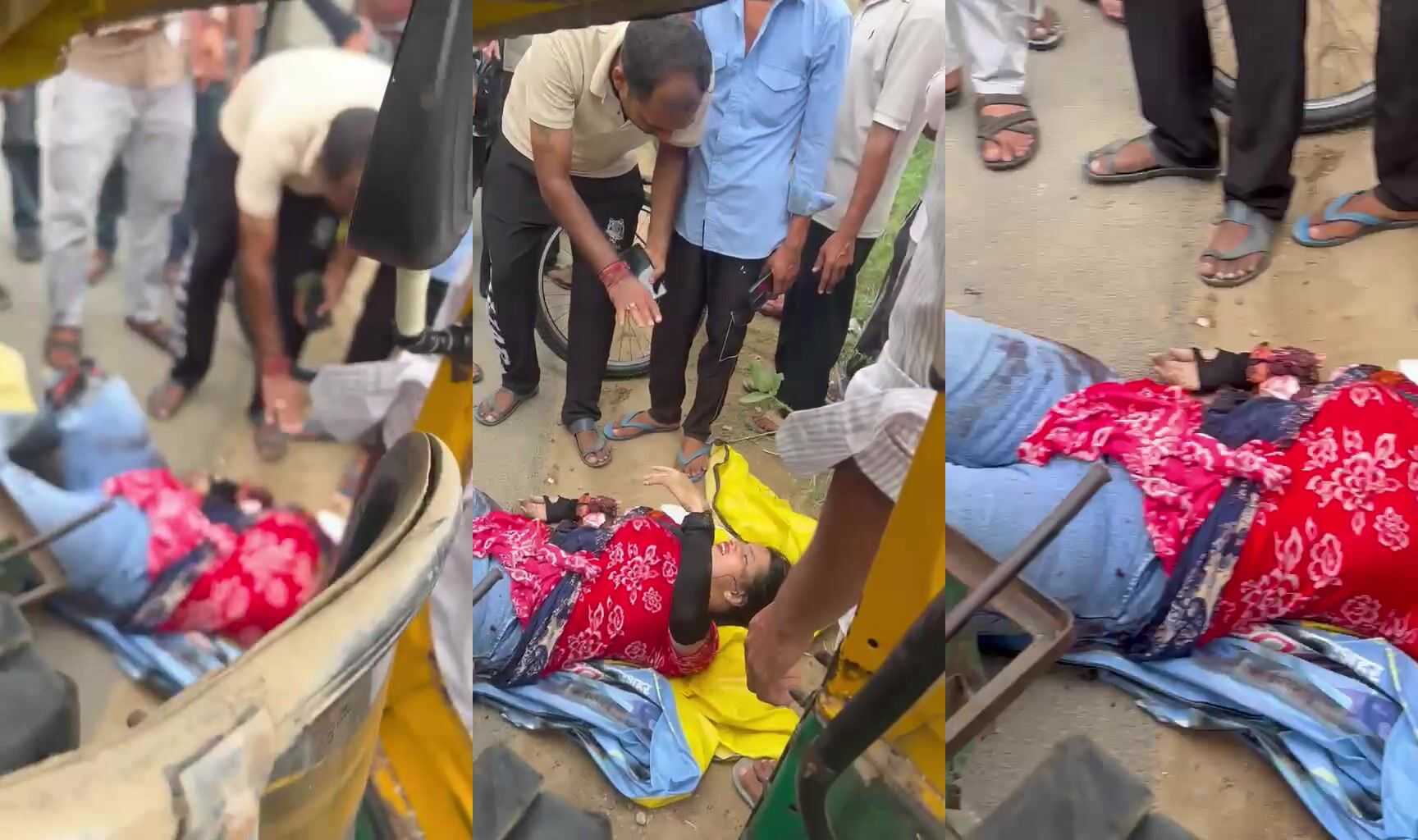 Tuktuk accident takes womans arm