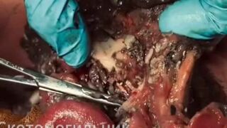 Ukr soldier rotting alive.