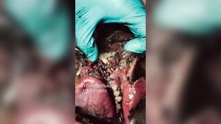 Ukr soldier rotting alive.