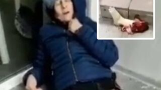 Ukr Nazi woman crying over her foot.