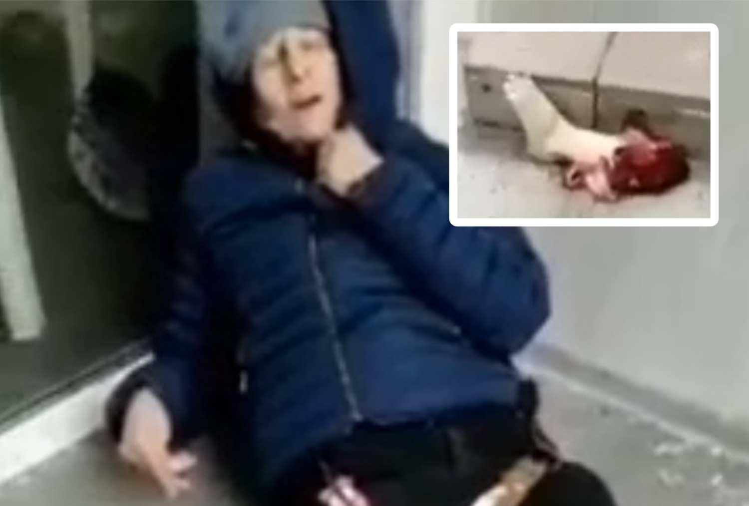Ukr Nazi woman crying over her foot.
