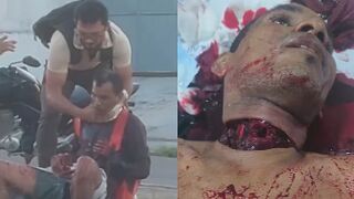 Motorcyclist Dies After Wire Slit His Throat