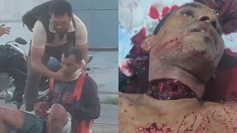 Motorcyclist Dies After Wire Slit His Throat