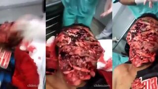 Dude With Machete Wounds to The Face & Doctors Laugh At The Noises He's Making (Classic Video)