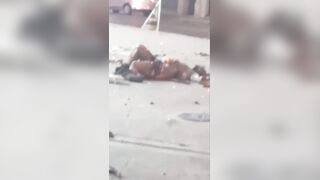 Gas Explosion Survivor Suffers Nasty Injuries & Fully Awake