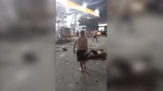 Gas Explosion Survivor Suffers Nasty Injuries & Fully Awake