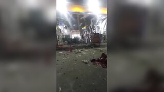 Gas Explosion Survivor Suffers Nasty Injuries & Fully Awake
