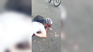 They Say Helmets Save Lives ...