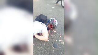They Say Helmets Save Lives ...